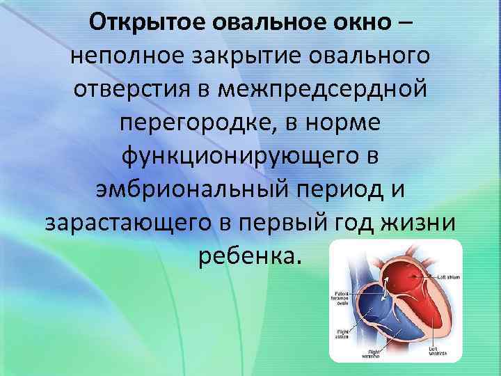 Открытое овальное окно - признаки, причины, симптомы, лечение и профилактика - idoctor.kz