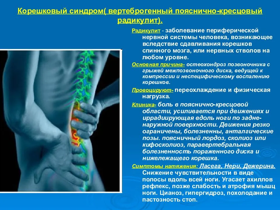 Виды радикулита, ишиас и люмбаго. лечение.