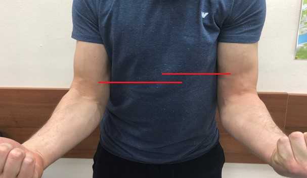 Бицепс (двуглавая мышца плеча) человека | анатомия бицепса, строение, функции, картинки на eurolab