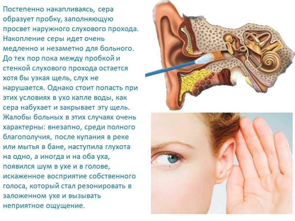Ухо человека и его строение: фото и схемы среднего уха, ушной раковины и других его частей