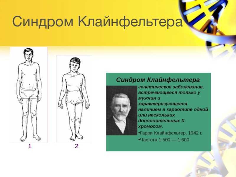 Презентация на тему синдром клайнфельтера генетика