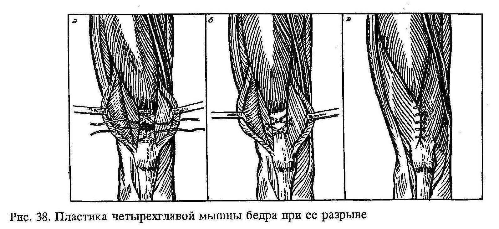 Сидение не укорачивает и не спазмирует сгибатели бедра | fpa