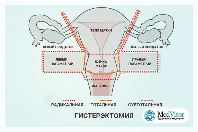 Схема матки с придатками
