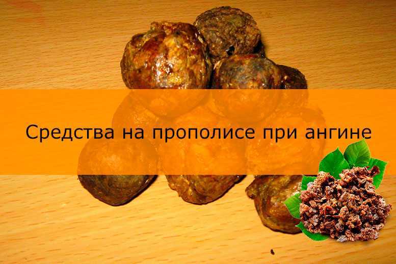Как быстро снять острую зубную боль – что делать и куда обращаться