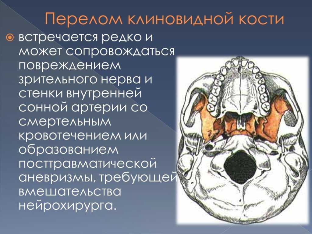 Лечение хронического полипозного риносинусита