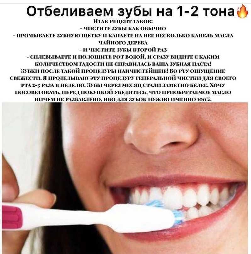 Отбеливание зубов: какие есть способы?