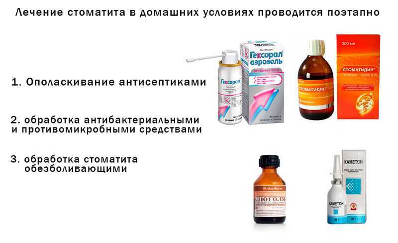 Лечение стоматита у взрослых препараты чем полоскать