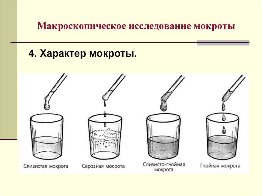 Туберкулез. виды. профилактика. осложнения