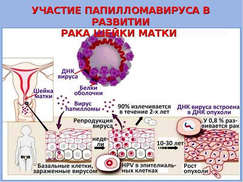 Вирус папилломы человека у мужчин: причины, симптомы, лечение
