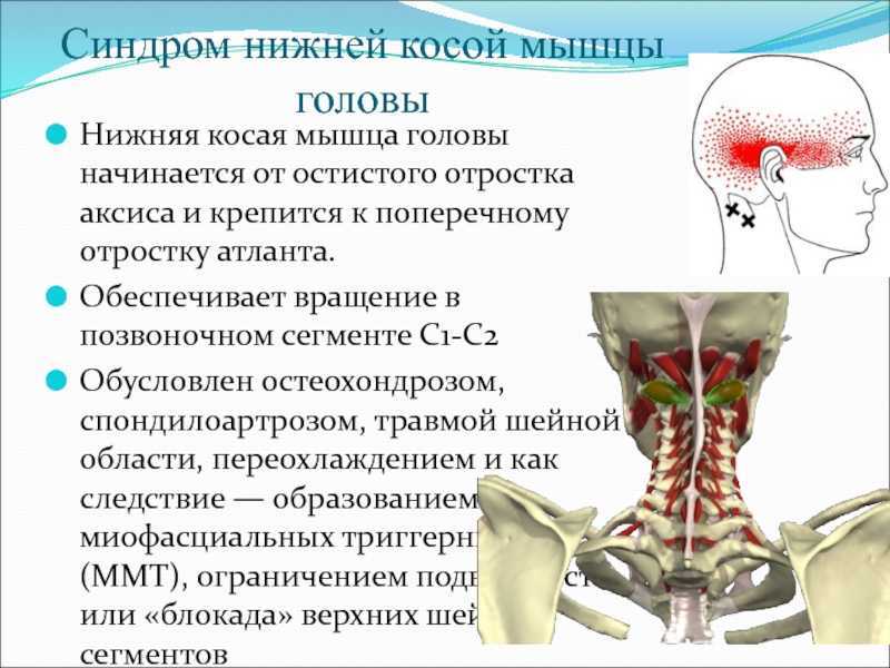 Мышечная активность при боли в шее | kinesiopro