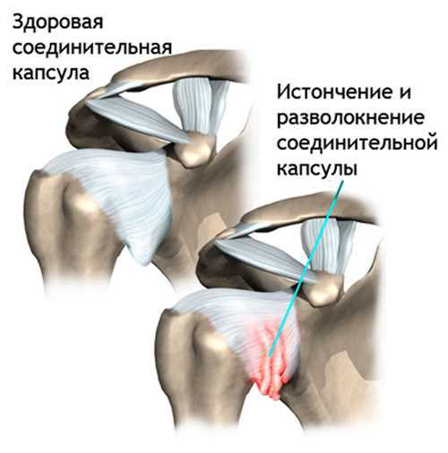 Какие бывают болезни коленного сустава: список самых распространенных