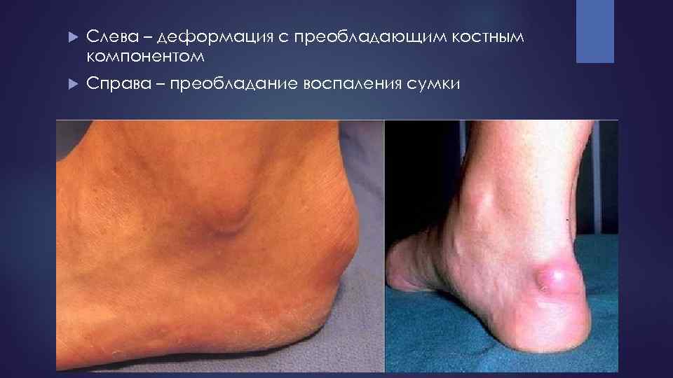 Может ли форма стопы рассказать о вашем происхождении