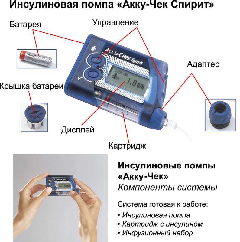 Инсулиновые помпы презентация