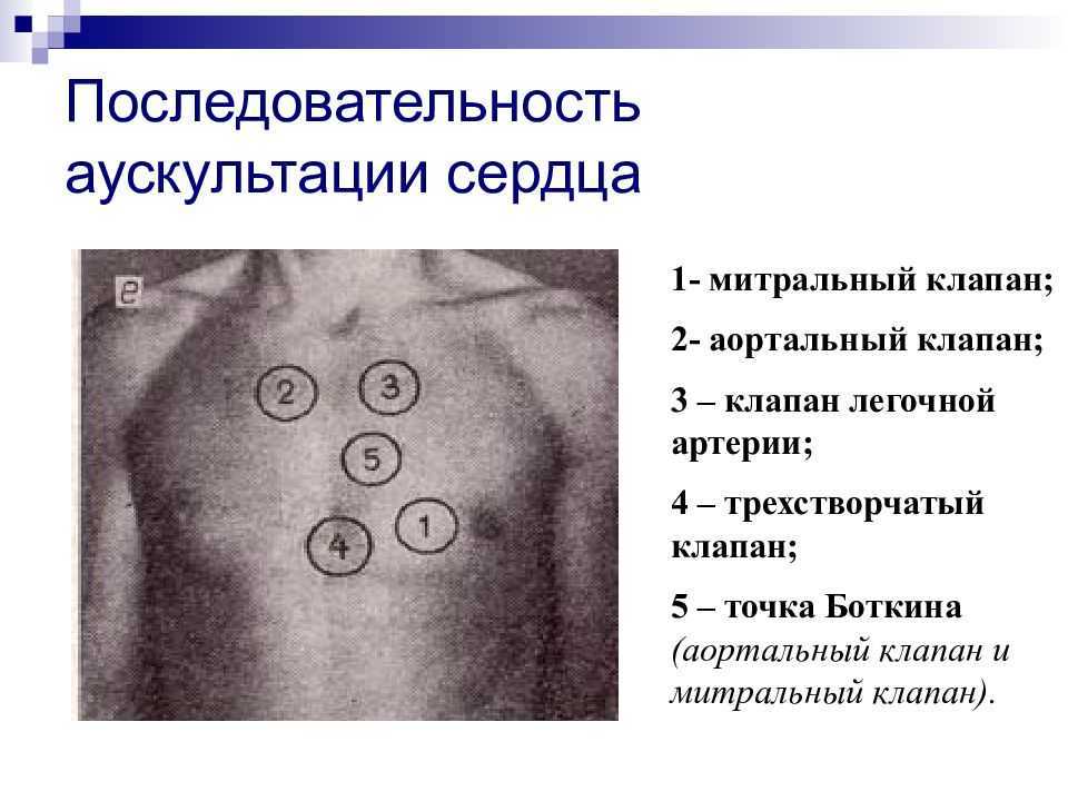 Точки аускультации сердца рисунок