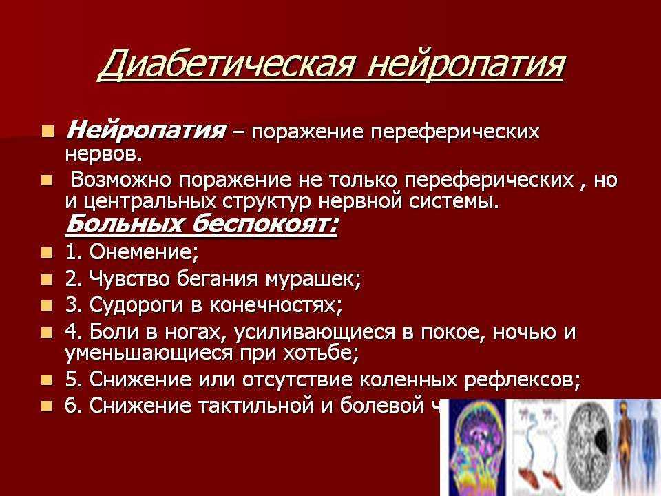 Диабетическая полинейропатия клиническая картина