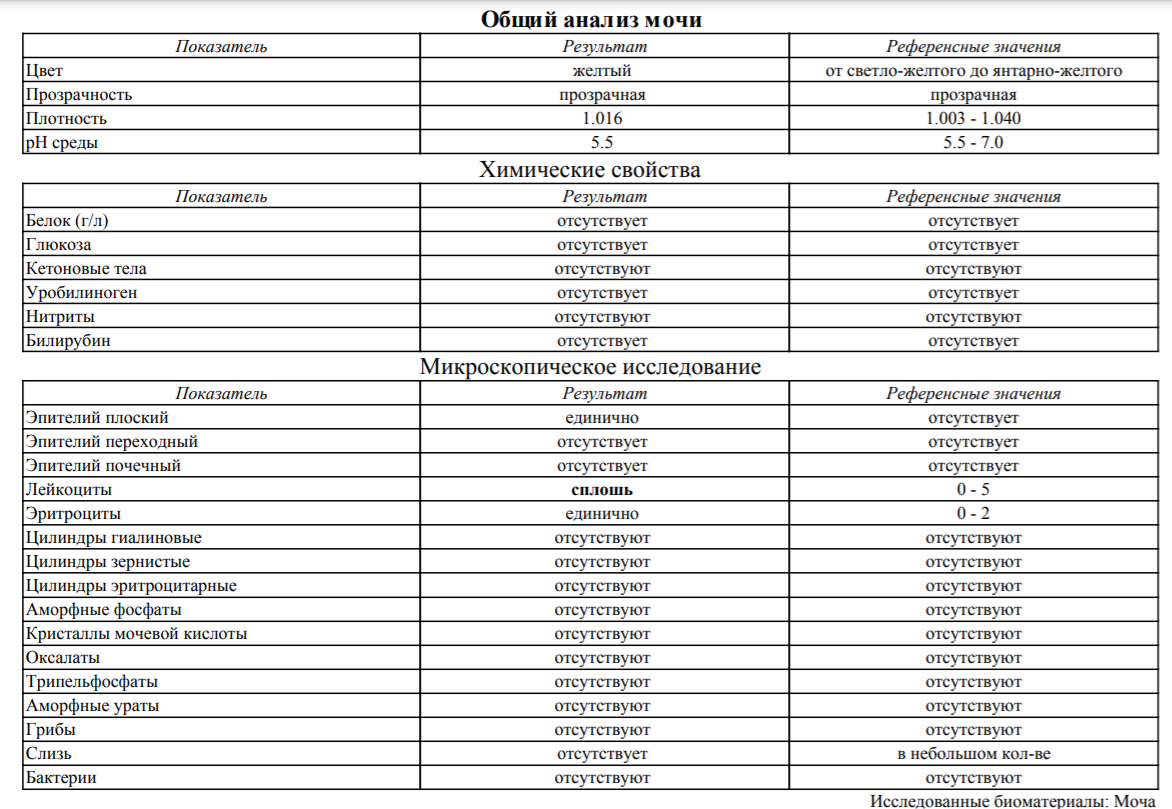 Анализ секрета простаты