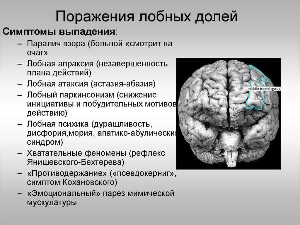 Ушиб головного мозга
