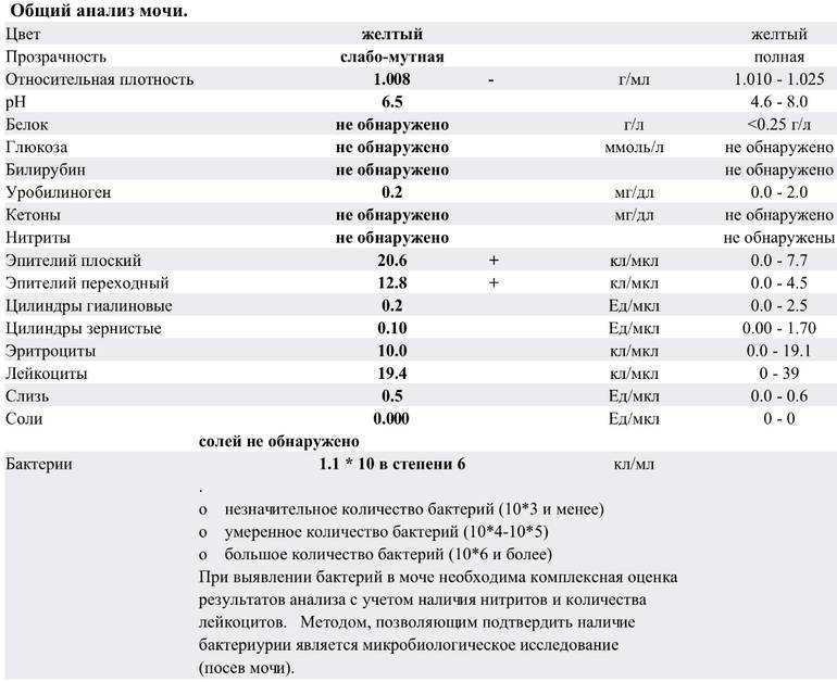 Общий анализ мочи с микроскопией осадка: исследования в лаборатории kdlmed