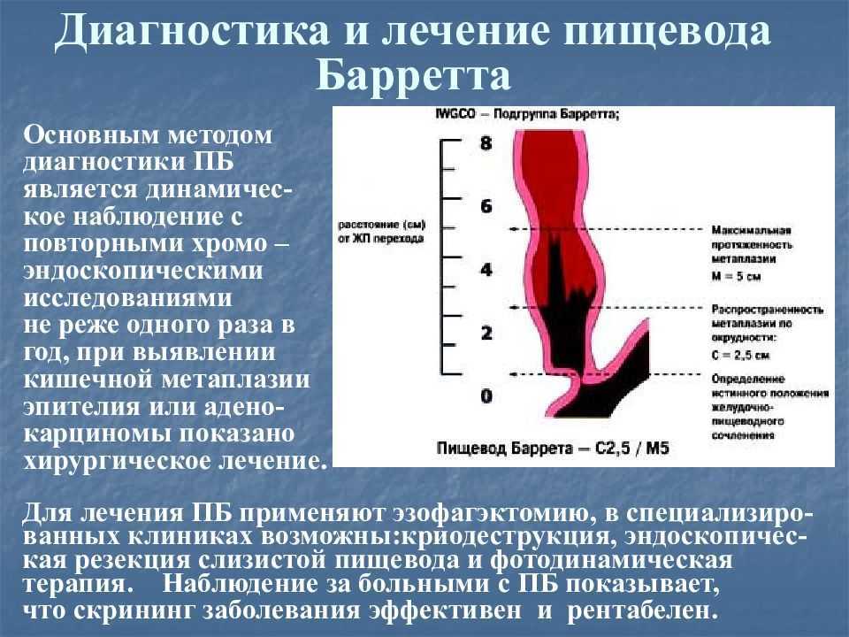 Гастроэзофагеальная рефлюксная болезнь: новый подход к причинам и лечению * клиника диана в санкт-петербурге