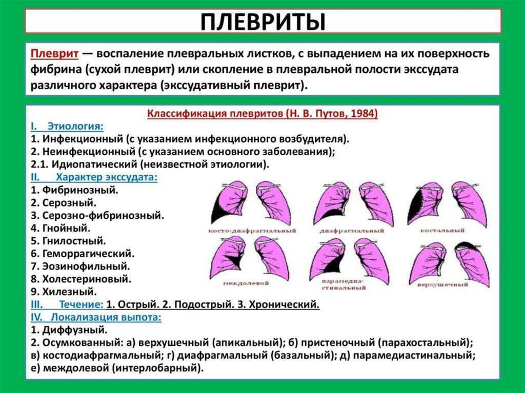 План лечения пневмонии у взрослого