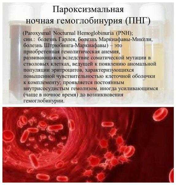 Пароксизмальное позиционное головокружение