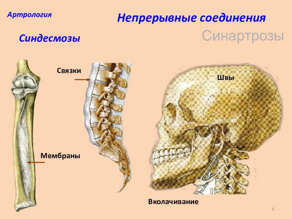 Непрерывные соединения. Непрерывное соединение костей синдесмозы. Синдесмоз и синостоз. Синдесмозы синхондрозы синостозы таблица.