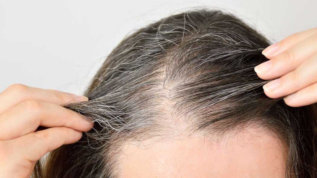 Как избавиться от вьющихся волос на висках