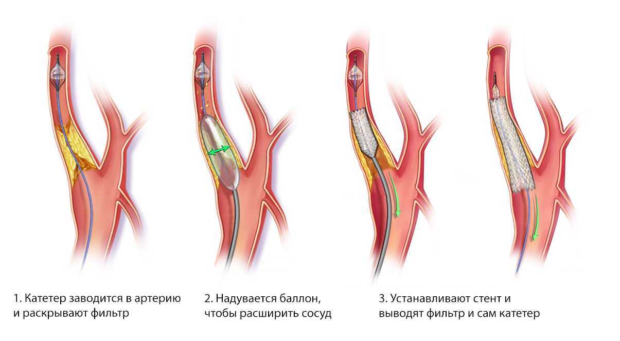 Анатомия вен нижних конечностей: глубокие, подкожные и поверхностные вены