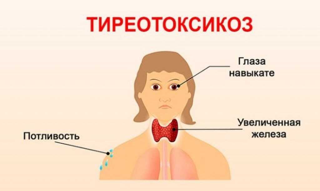 Щитовидка где находится схема у женщины фото