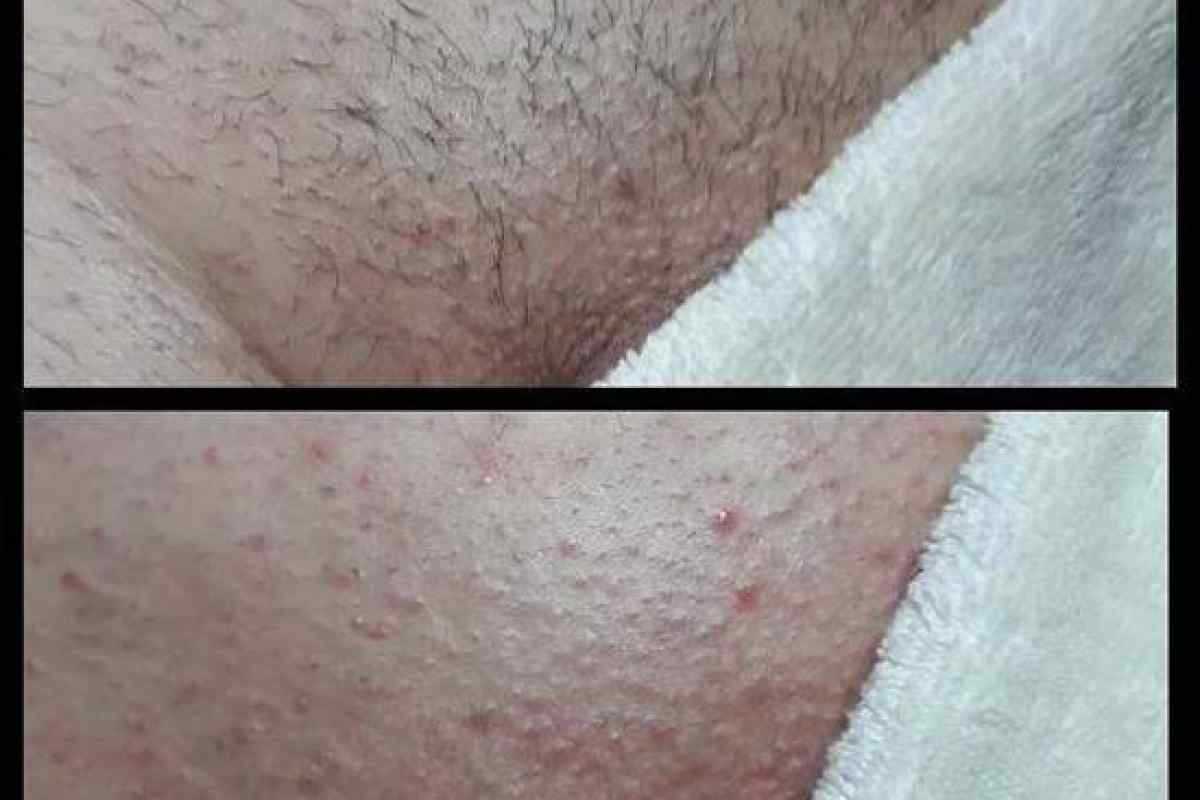 Можно ли детским кремом мазать ноги после бритья