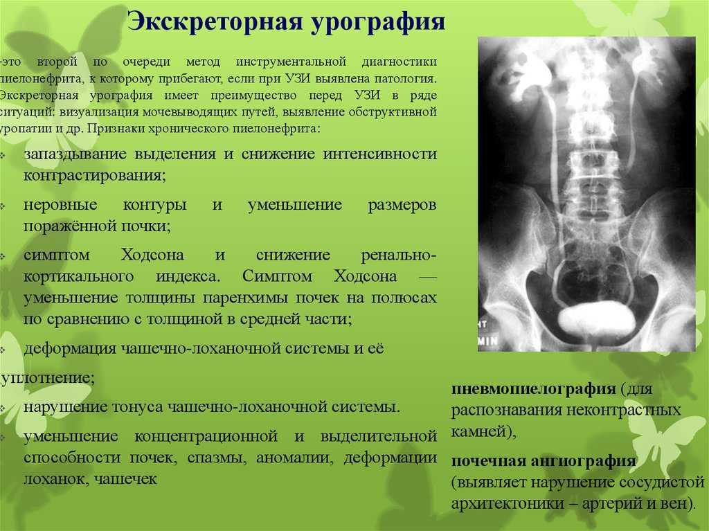 Рентгенография шейного отдела позвоночника