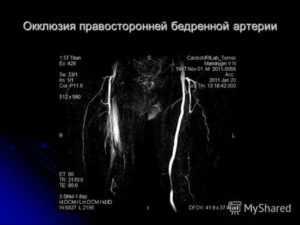 Передняя большеберцовая артерия - anterior tibial artery - abcdef.wiki