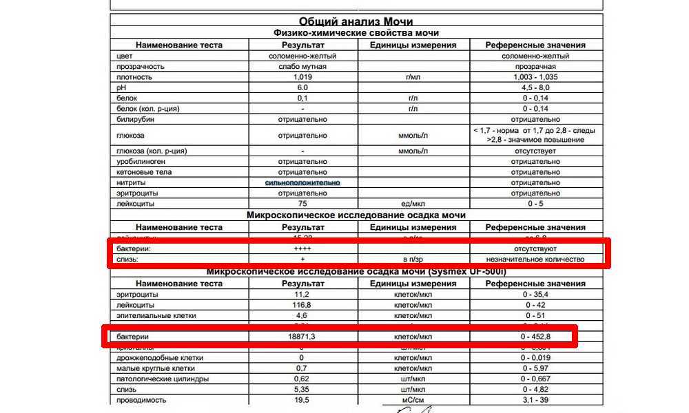 Кое в моче. Бактерии в моче ОАМ норма. Моча бактерии норма таблица. Норма микроорганизмов в моче у беременных. Анализ мочи на бактерии расшифровка.