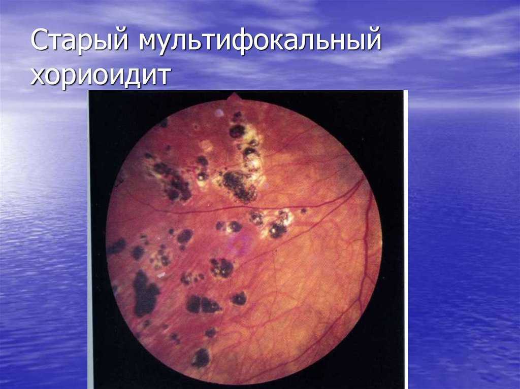 Строение и функции глаза