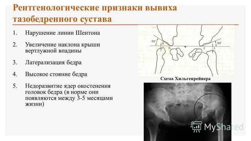 Биопсия шейки матки как метод диагностики. виды биопсии шейки матки. показания для проведения процедуры