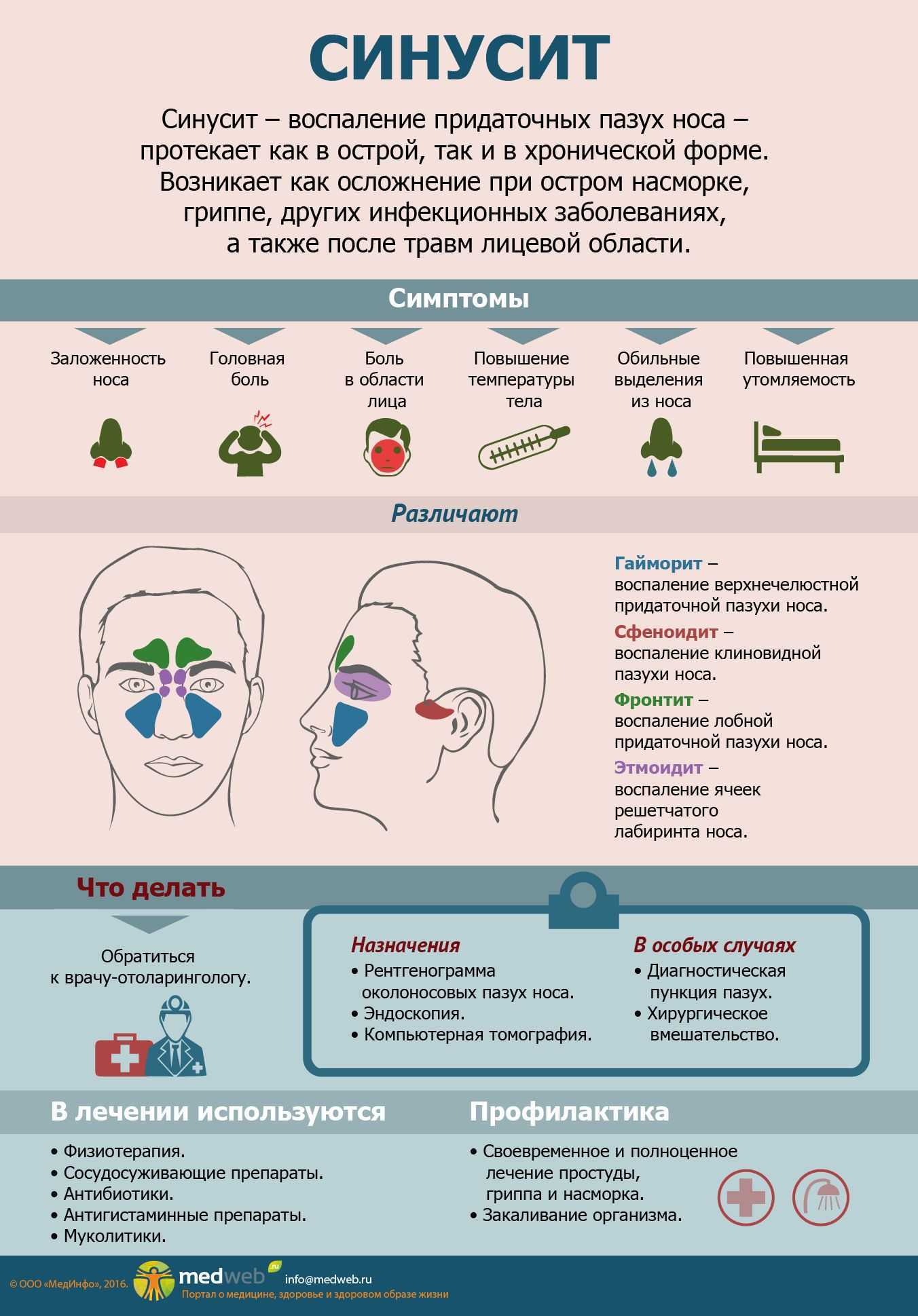 Синусит – симптомы, лечение, профилактика. виды синусита: гайморит, фронтит, этмоидит.