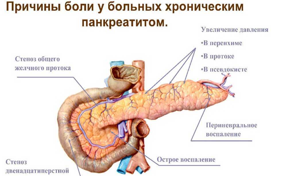 Панкреатит - что вызывает это заболевание? как его диагностировать и лечить? часть 1 * клиника диана в санкт-петербурге
