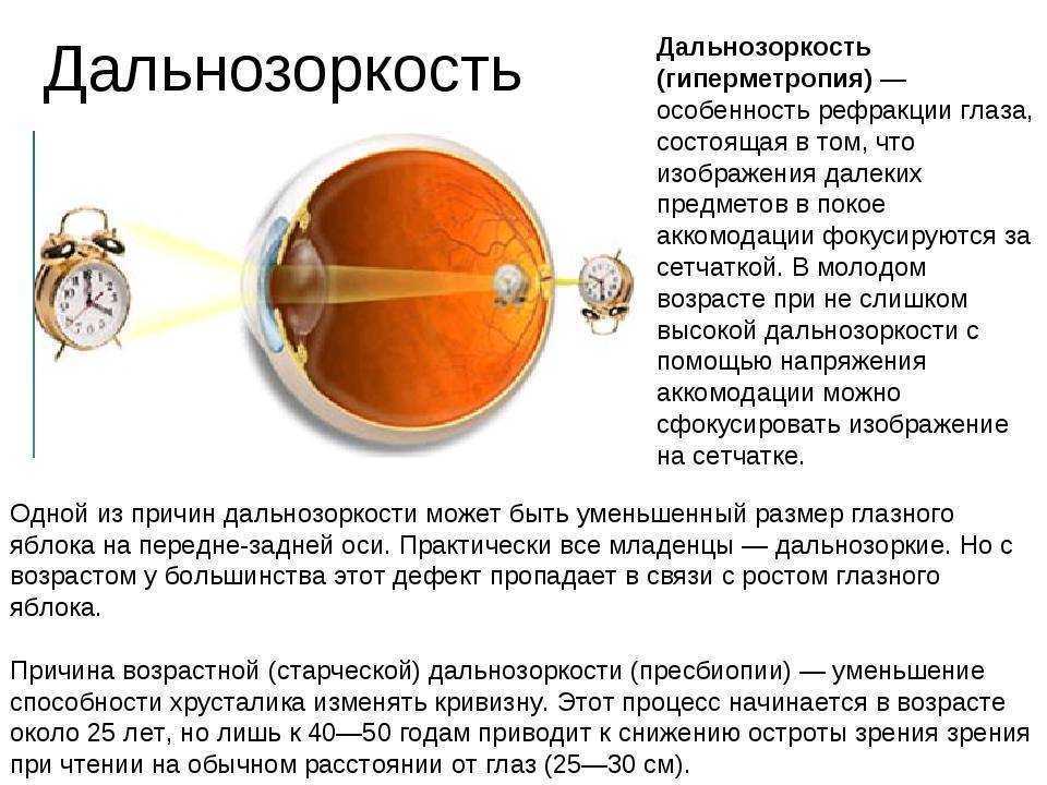 Аккомодация