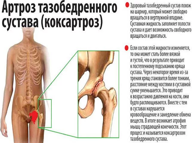 Узи вен нижних конечностей: все, что нужно знать перед посещением