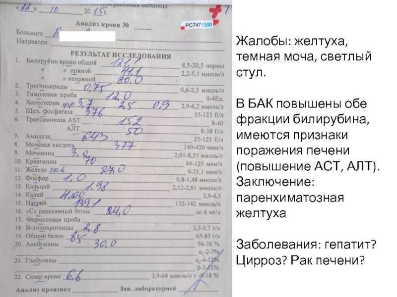 Стоит ли паниковать из-за повышенного холестерина?