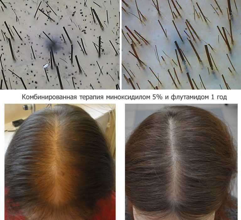 Как по волосам определить проблемы со здоровьем