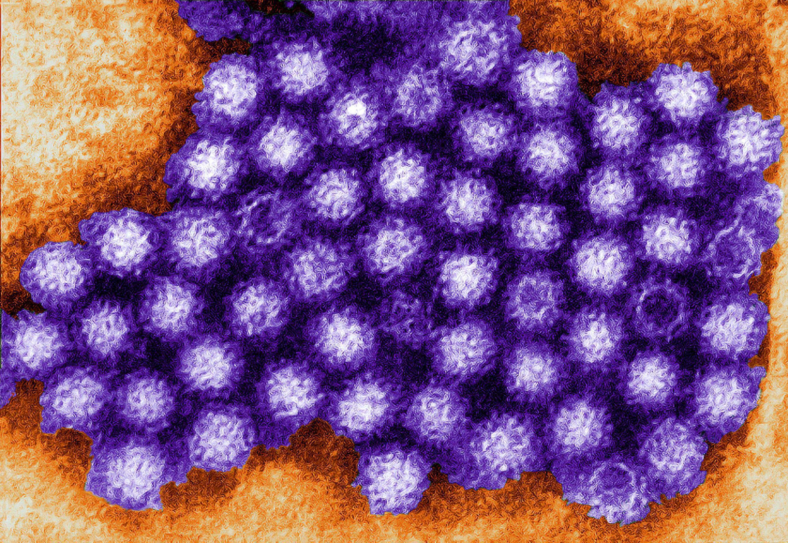 Аденовирус гриппа. Норовирус микробиология. Ротавирус норовирус астровирус. Вирус Норуолк. Норовирус аденовирус.