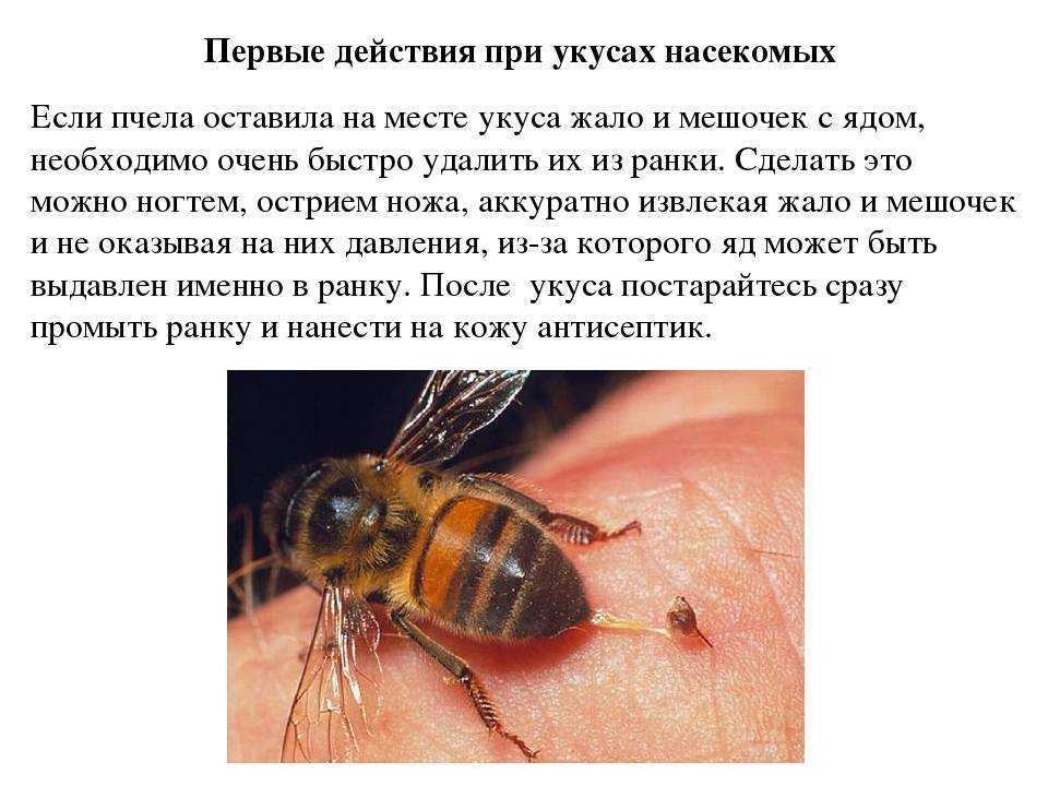 Что делать при укусе пчелы. Первая помощь при укусе пчелы. Сколько укусов пчел