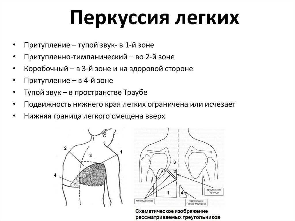 Перкуссия легких: сравнительная и топографическая, норма и границы | prof-medstail.ru