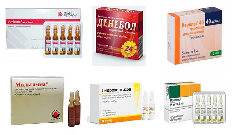 Послеоперационные боли: как уменьшить, применение нестероидных противовоспалительных препаратов | мотрин®