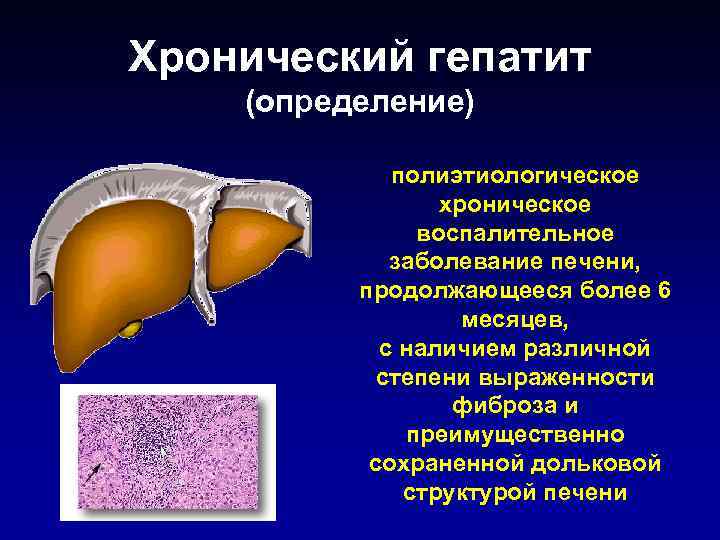 Что такое хронический гепатит