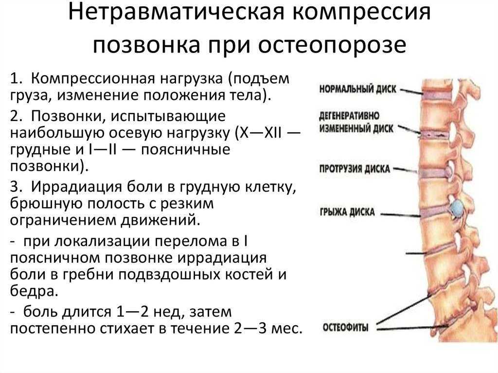 Компрессионный перелом позвоночника карта вызова
