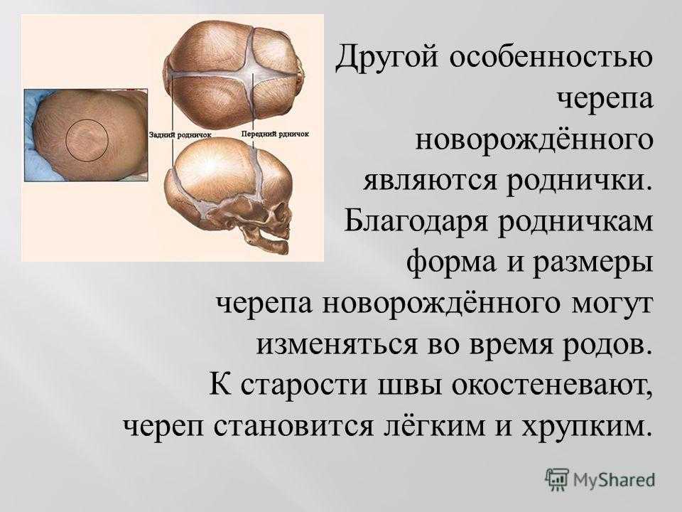 Типы родничков. Роднички функции родничков. Роднички черепа новорожденного. Швы и роднички черепа новорожденного. Череп в целом швы и роднички.