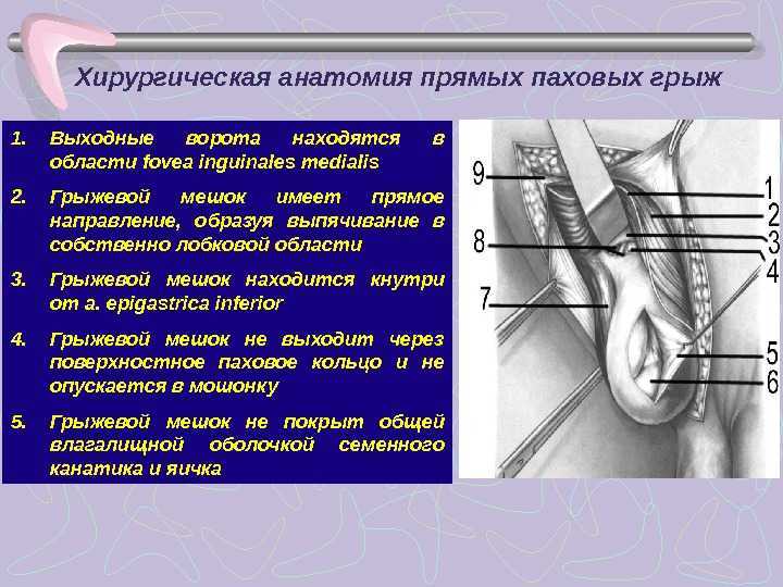 Паховая грыжа у мужчин: фото, симптомы и лечение без операции