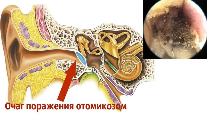 Резь в глазах